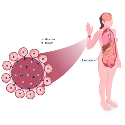 Pcos And Insulin Resistance Lilli Health