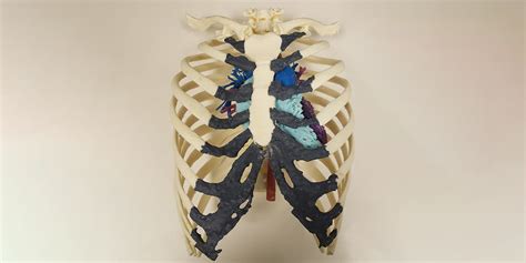 Point Of Care 3d Printing Improves Patient Outcomes At Nemours Materialise Innovators You