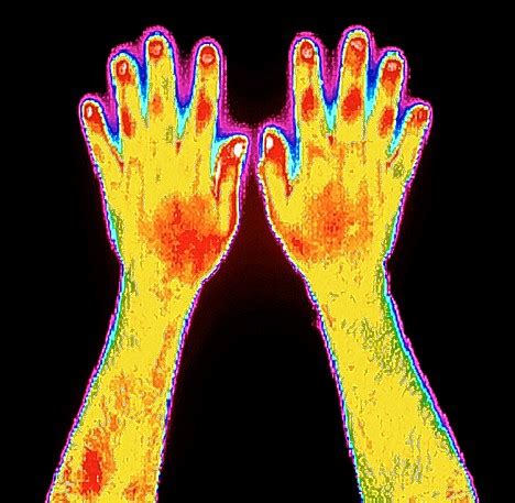 doctor stinging hands   husband awake daily mail