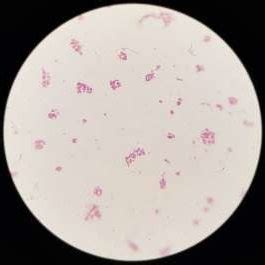 Arrangement of Corynebacterium spp. by Gram's stain showing... | Download Scientific Diagram