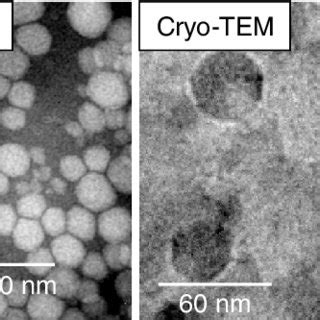 Transmission electronic microscopy (TEM) and Cryo-TEM visualization of... | Download Scientific ...