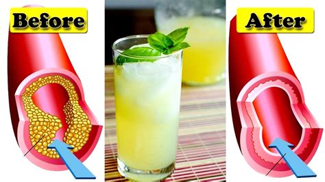 Only A Glass Of This Juice Will Remove Clogged Arteries And Control