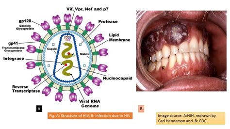 Hiv Human Immunodeficiency Virus History Introduction Morphology