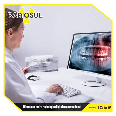 Radiosul Digital Diferenças Entre Radiologia Digital E Convencional