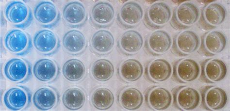 Difference Between Bradford And Lowry Protein Assay Compare