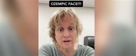 What To Know About Ozempic Face As Some Users Claim Popular Diabetes