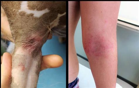 Dermatitis At Pica En Personas Y En Perros Se Trata De La Misma