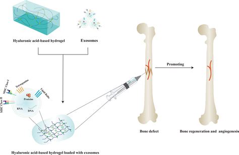 Frontiers Hyaluronic Acid Based Hydrogels As An Exosome Delivery