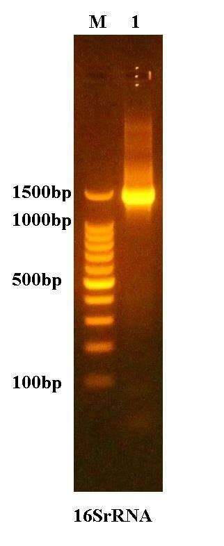 1 Gel Electrophoresis Of Amplified 16s Rrna Gene Using E Coli O157h7