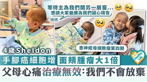 生命鬥士︳4歲sheldon手腳癌細胞增多、面頰腫瘤大1倍 父母心痛治療無效：我們不會放棄 晴報 健康 腫瘤及癌症 D220324