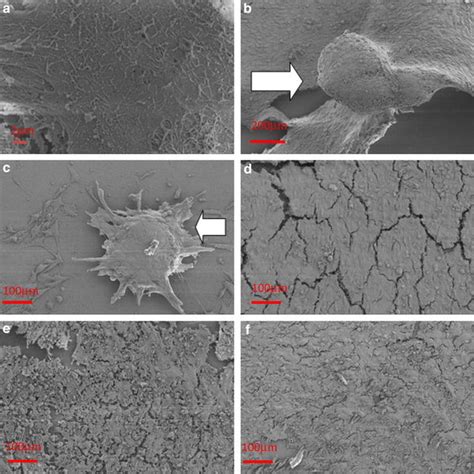 Sem Micrographs Of Osteoblast Like Cells Cultured On Silane Modified