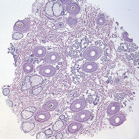 Transverse Section Of A 4 Mm Punch Biopsy Of Healthy Scalp Skin From A