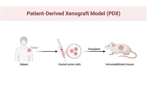 Simplified Overview Of Patient Derived Xenograft Model Pdx Patient