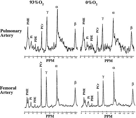 Typical 31 P Nmr Spectra Collected Over 30 Min From Pulmonary And Download Scientific Diagram