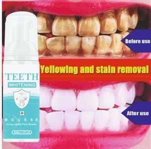 SKOOKUM Teeth Whitening Liquid For Dream White Teeth And Mouth Wash