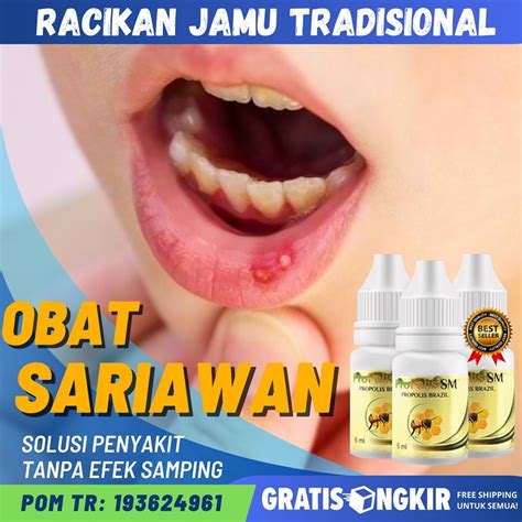 Jual Obat Sariawan Di Bibir Mulut Gusi Sariawan Di Lidah Luka Lecet Di