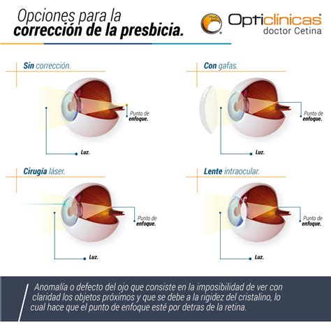 Cirugía Para La Presbicia Y Tratamientos Para Corregirla