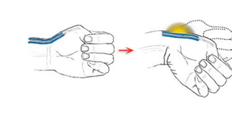 Sindrome De Quervain Test Fisiotop Academy