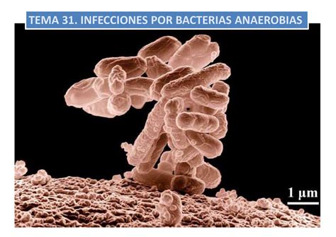 Tema 31 Bacterias Anaerobias TEMA 31 INFECCIONES POR BACTERIAS