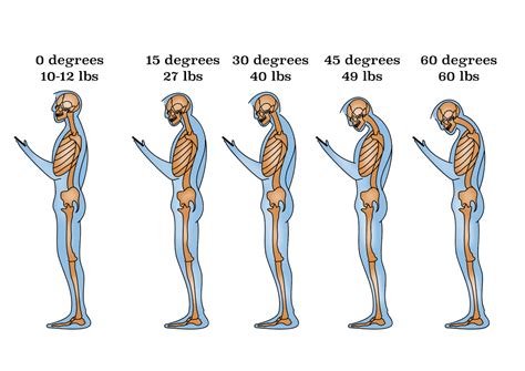 text neck  head posture