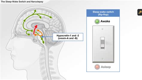 Understanding Narcolepsy A D A M Ondemand