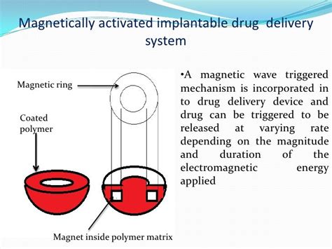 Implantable Drug Delivery System