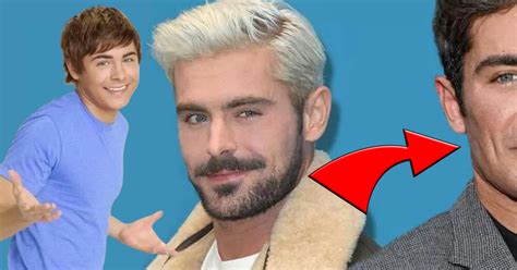 Zac Efron Méconnaissable Après Une Chirurgie Sa Transformation