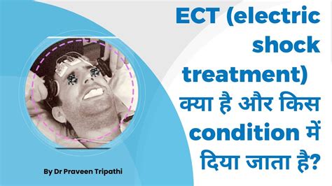 Ect Electroconvulsive Therapy Ya Electric Shock Treatment Kya Hai