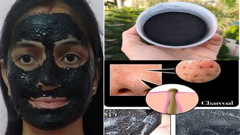 Homemade Activated Charcoal Peel Off Mask For Whiteheads And Blackheads Get Clear And Glowing Skin