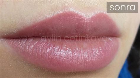 Permanent Lip Color Tattoo In Istanbul Turkey