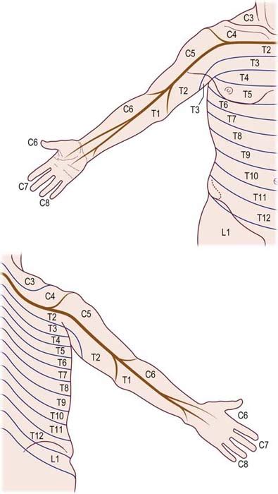 Radiculopathy Neupsy Key