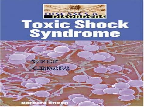 Toxic Shock Syndrome Ppt