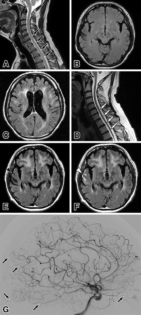 Figure1 Radiological Findings Of The Patient A B Magnetic Resonance