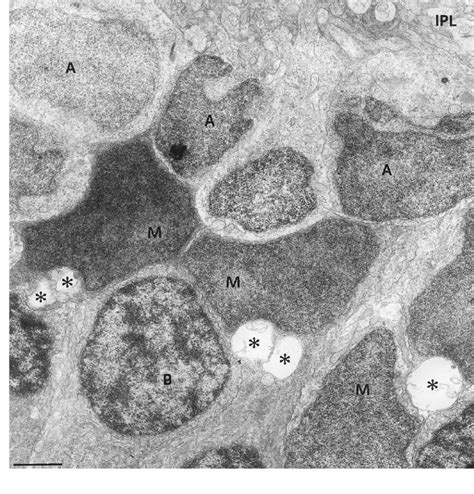 Transmission Electron Microphotograph From The Inner Nuclear Layer