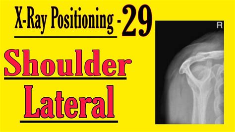 Shoulder Lateral Positioning Hindi X Ray Positioning For