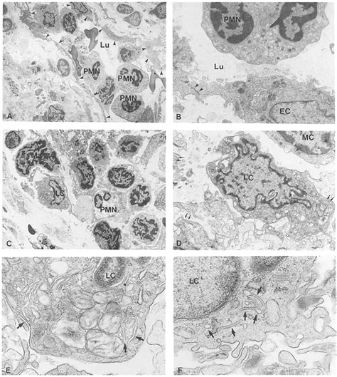 The Effect Of Gm Csf On The Cells Of The Dermis Transmission Electron