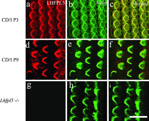 Confocal Images Of Immunofluorescence Labelling For Lhfpl Red And