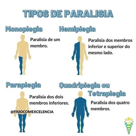 Fisio Excelência on Instagram Tipos de Paralisia Sigam