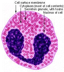 Urine eosinophils - Renal Fellow Network