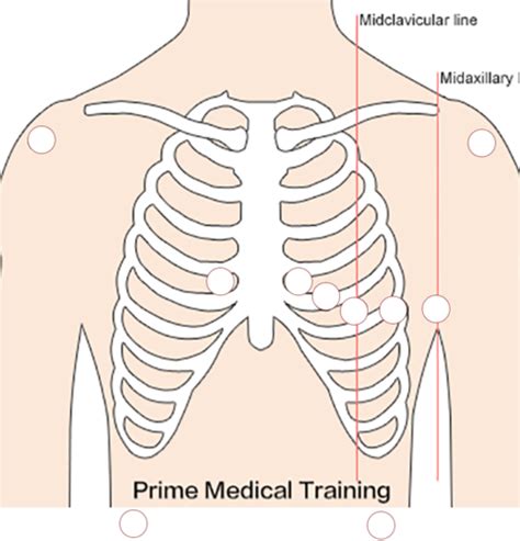 5 Lead EKG Placement And 12 Lead EKG Placement Flashcards Quizlet