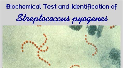 Biochemical Test Of Bacteria Streptococcus Pyogenes Biochemical