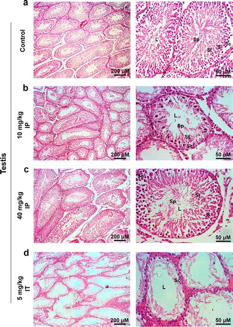 H E Stained Testicular Sections Of Busulfan Injected Rats A Normal