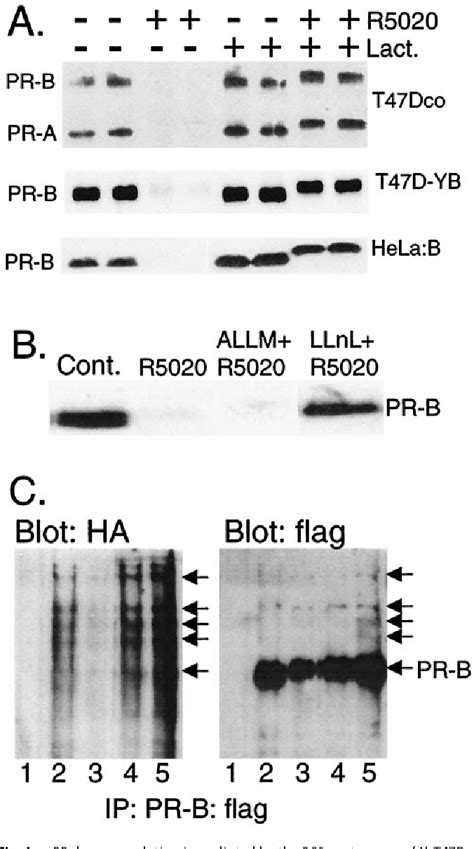 Figure 1 From Phosphorylation Of Human Progesterone Receptors At Serine 294 By Mitogen Activated