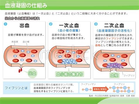 血液凝固仕組み Sword