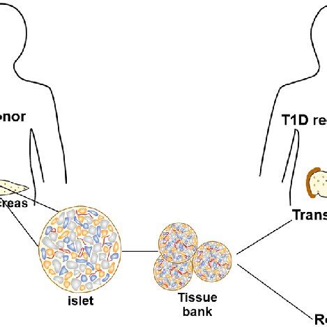 Isolation Of Human Islets For Tissue Bank Human Islets Isolated From