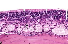 Olfactory Epithelium Histology