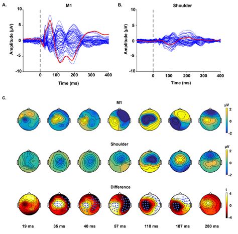 Tms Evoked Potentials Following Suprathreshold Biphasic Stimulation