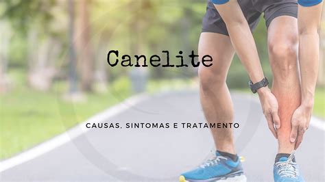 Canelite Causas Sintomas E Tratamento