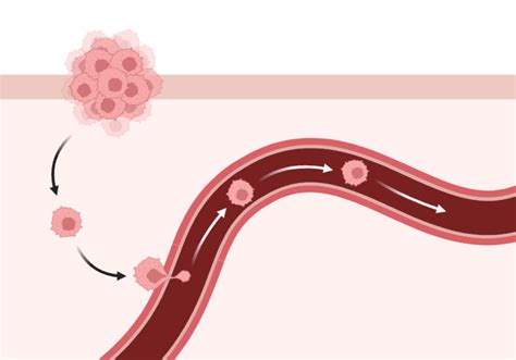 Tumor Cell Metastasis | BioRender Science Templates