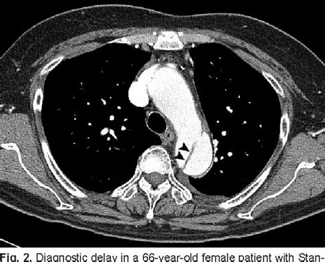 Figure 2 From Current Concepts In Cardiac Ct Angiography For Patients